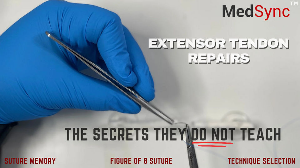 Tendon Repair Secrets I Wish I Knew Earlier